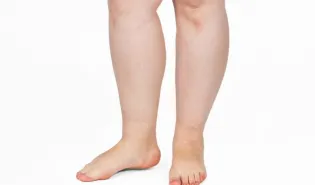 remede de grand mere pour les pieds gonfles
